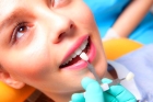 Циркониевые виниры на передние зубы