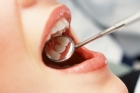 Лечение пульпита 2 корневого зуба