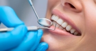 Лечение пульпита 3 корневого зуба
