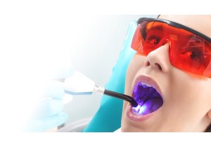 Отбеливание зубов диодным лазером 