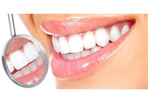 Отбеливание зубов лазером Epiс