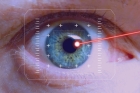 Коррекция зрения LASIK (лазерный кератомилез)